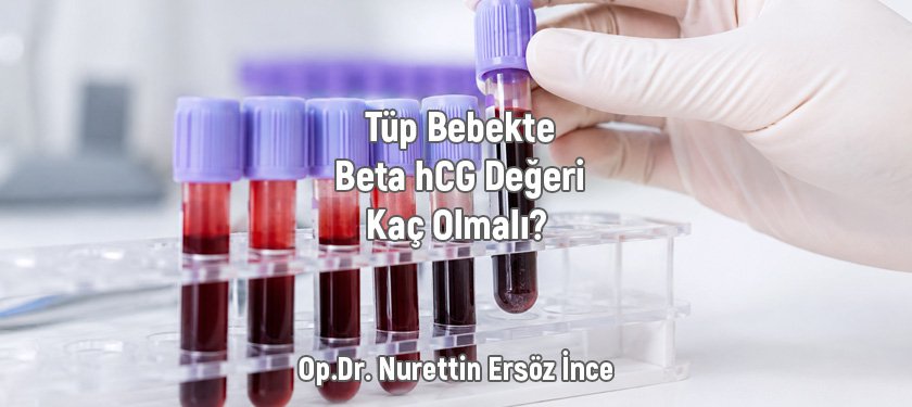 Tüp Bebekte Beta hCG Değeri Kaç Olmalı? Transfer Sonrası Beta hCG Sonuçlarının Değerlendirilmesi