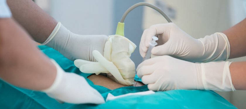 Amniosentez Nedir ?